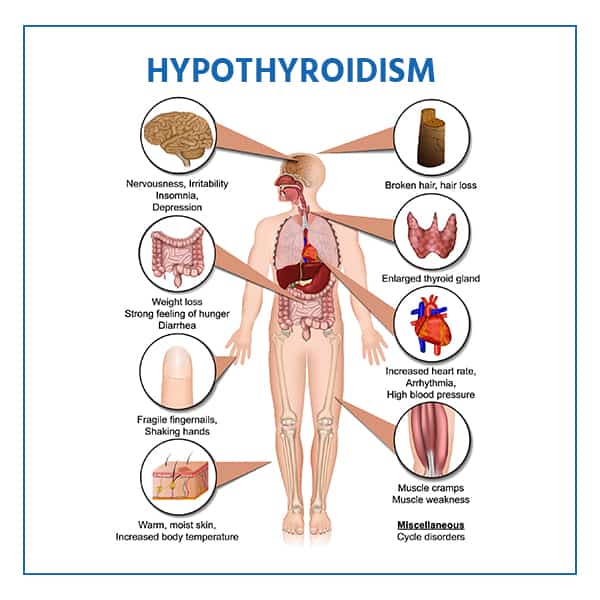 Medication For Hypothyroidism: Tips & Supplements